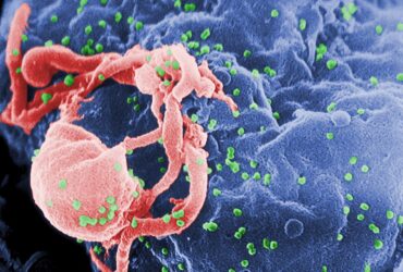 Penelitian Para Ilmuan Menggunakan Tikus Sebagai Penyembuhan Hiv