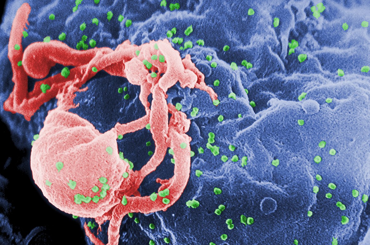 Penelitian Para Ilmuan Menggunakan Tikus Sebagai Penyembuhan Hiv