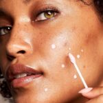 Fakta Yang Harus Kamu Ketahui Soal Acne Shaming Pada Perempuan Di Indonesia