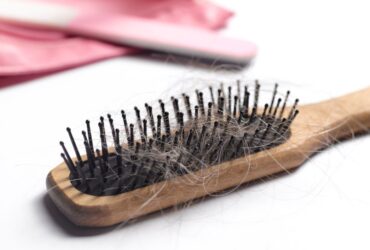 Benarkah Stress Jadi Salah Satu Penyebab Dari Rambut Rontok?