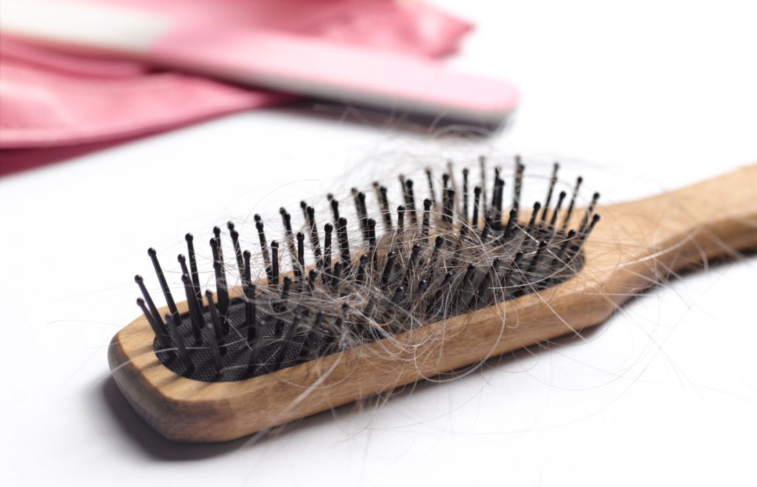 Benarkah Stress Jadi Salah Satu Penyebab Dari Rambut Rontok?