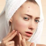 Menurut Dermatologis