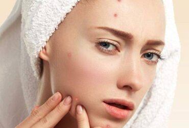 Menurut Dermatologis