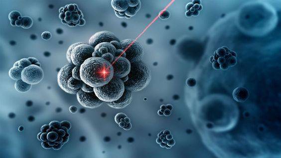 Artificial Intelligence (Ai): Kurangi Kesalahan Diagnosa Deteksi Kanker Payudara