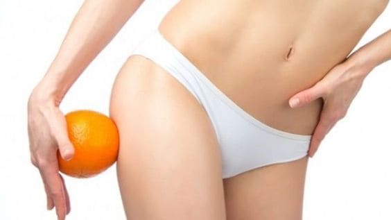 Timbul Selulit Di Kulit Mengganggu? Coba Cara Ini
