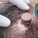Neuralinkelonmusk